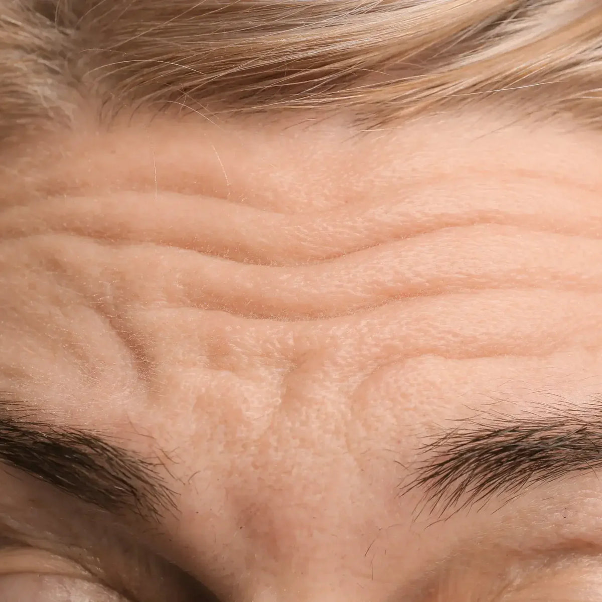 1. “Wrinkles are simply a sign of getting older”