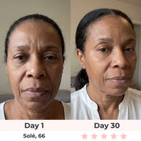 Aurelia 7-in-1 LED Face Mask