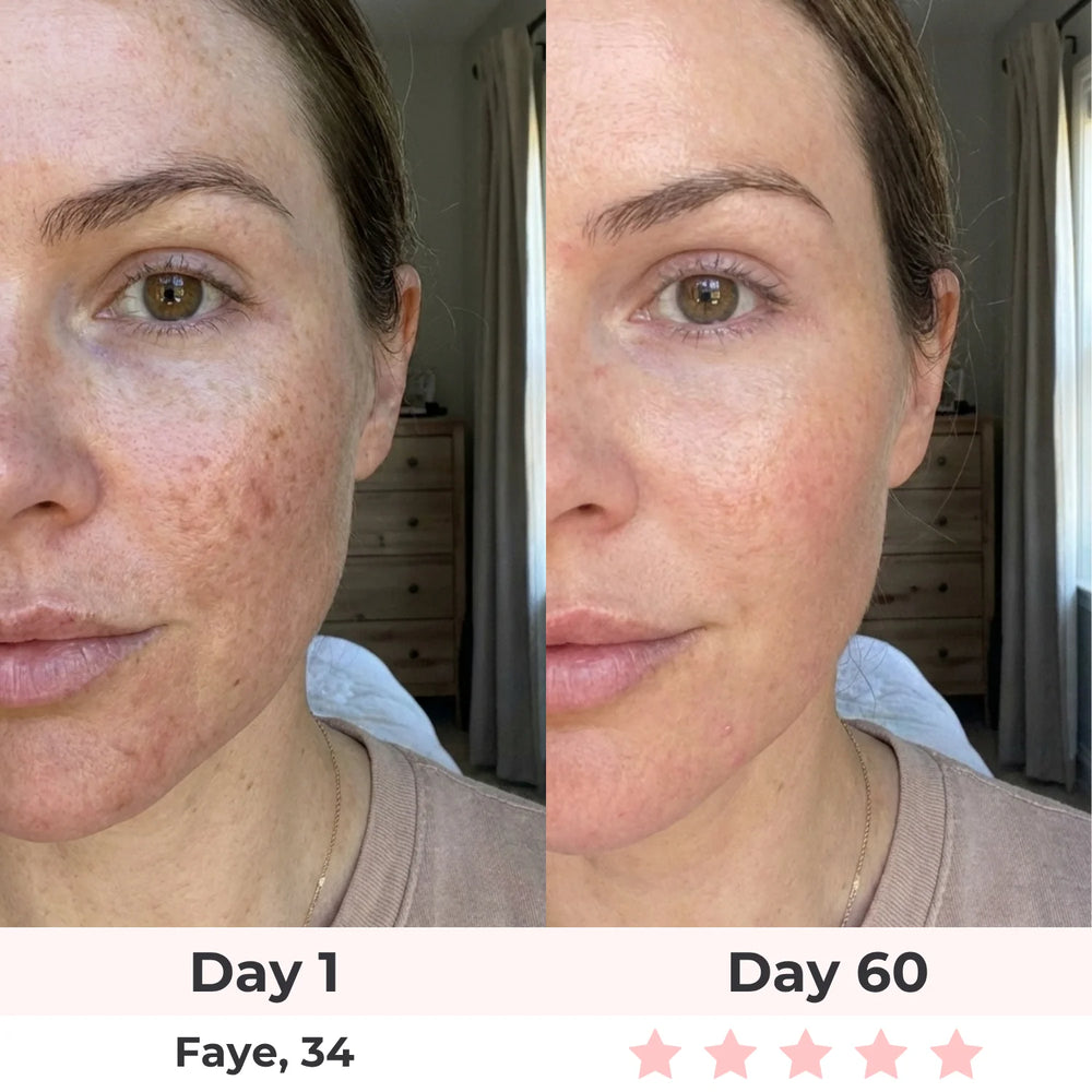 Goodbye dry patches