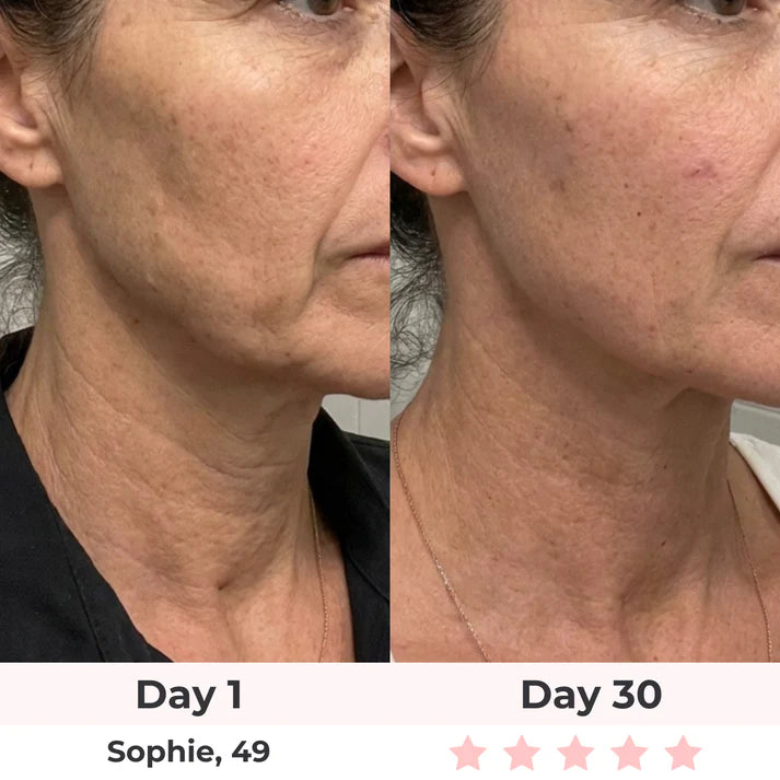 Aurelia 7-in-1 LED Facial Sculpting
