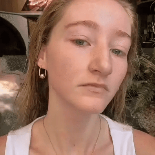 Prevent Acne Breakouts